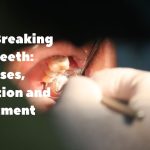 tartar breaking off teeth