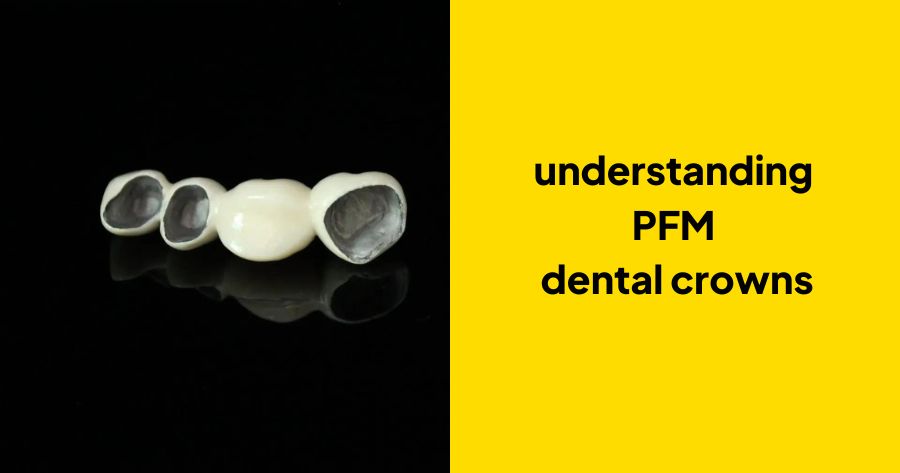 pfm dental crowns